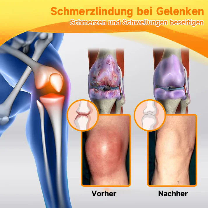Bienen-Vital-Creme | Schnelle Schmerzlinderung | Karnz