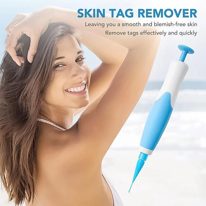 Skin Tag Entferner Kit | Nicht-invasiv & Effektiv | Karnz