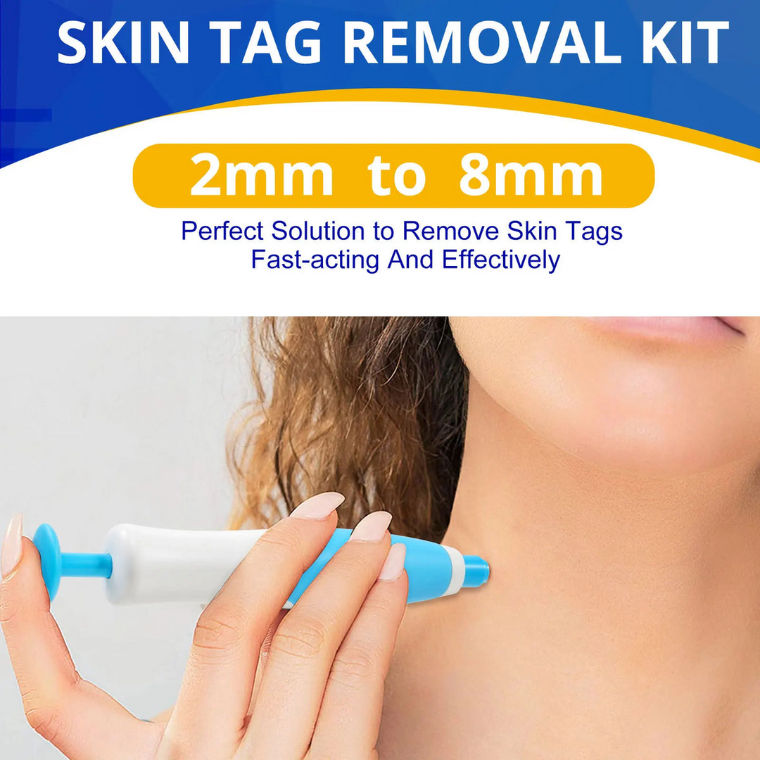 Skin Tag Entferner Kit | Nicht-invasiv & Effektiv | Karnz