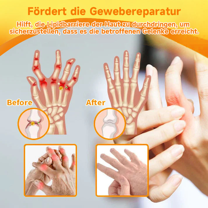 Bienen-Vital-Creme | Schnelle Schmerzlinderung | Karnz