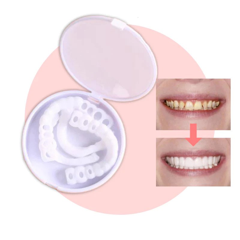 Snap-on Teeth™ – Mit diesen Veneers haben Sie immer ein perfektes Lächeln.