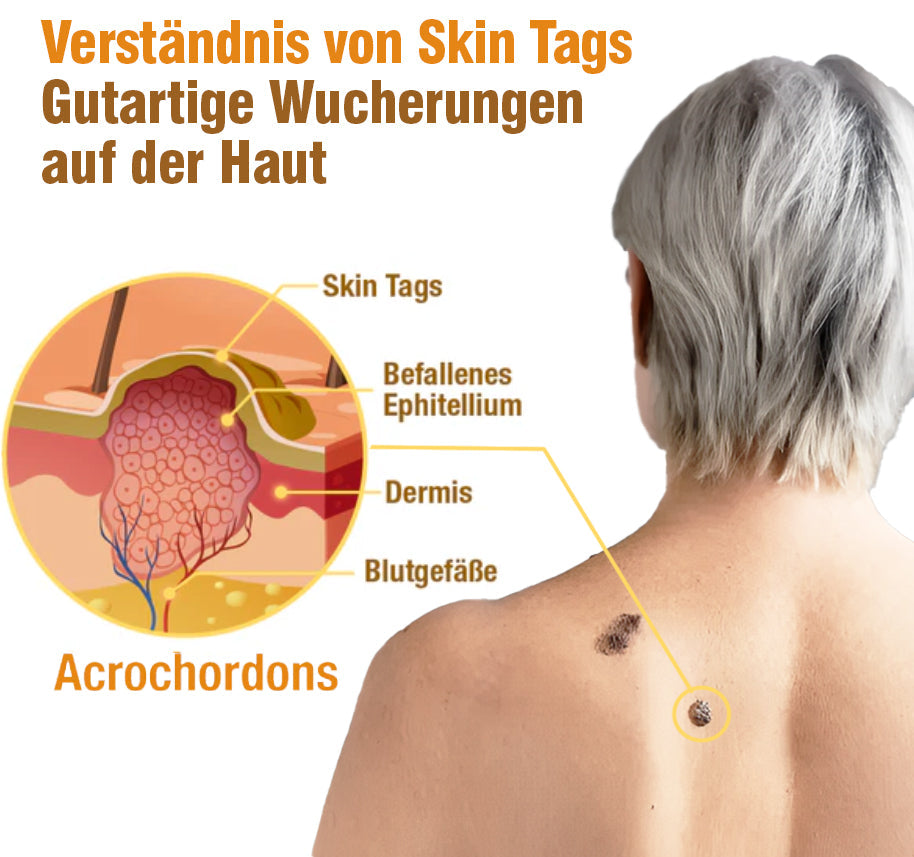 TagRecede Bee Geschenk Spray | Natürliche Hautperfektion | Karnz