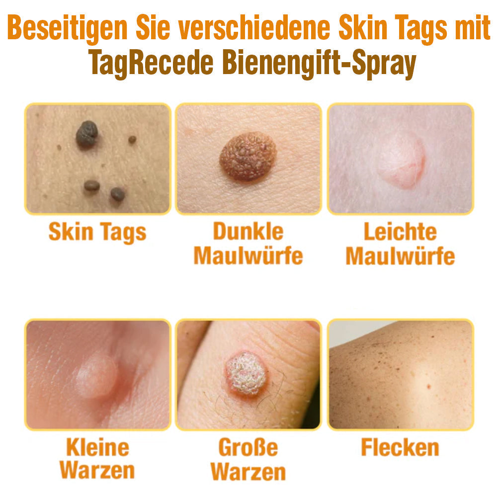 TagRecede Bee Geschenk Spray | Natürliche Hautperfektion | Karnz