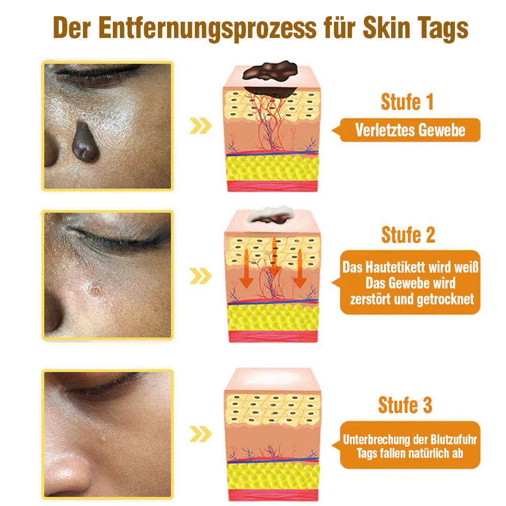 TagRecede Bee Geschenk Spray | Natürliche Hautperfektion | Karnz