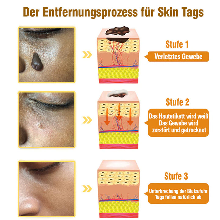 TagRecede Bee Geschenk Spray | Natürliche Hautperfektion | Karnz