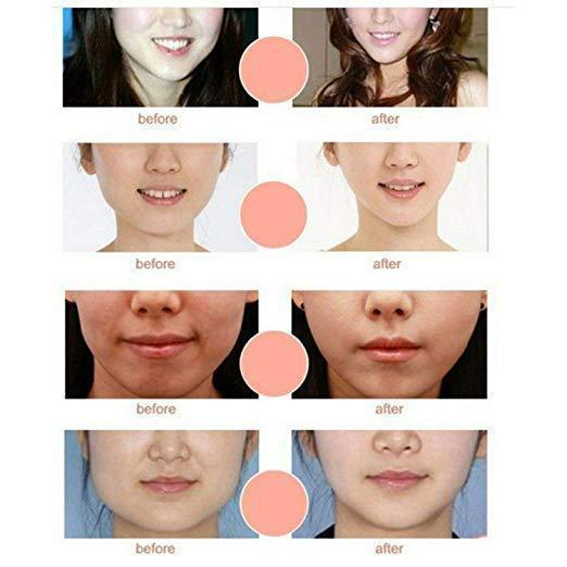 Karnz | V-Line Kinn-Hoch-Gesichtslift-Maske